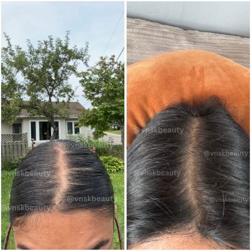 Filled in hair gaps
